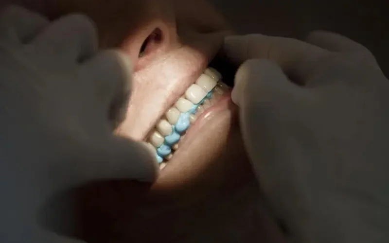 Les Européens soignent leur sourire au Maroc