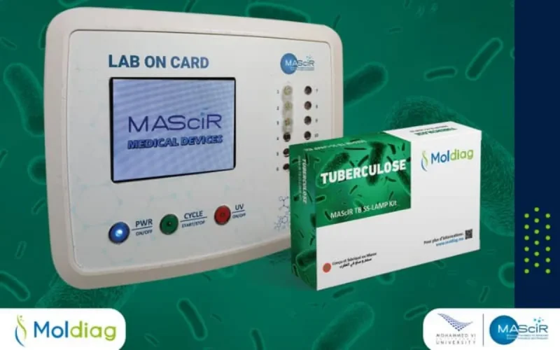 Tuberculose : le premier test 100 % marocain de dépistage mis sur le marché