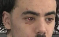 Anderlecht : il frappe un policier en le prenant pour un cambrioleur