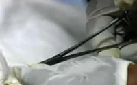 Circoncision : Des bistouris et des hommes