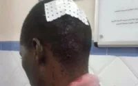 Tanger : affrontements entre Marocains et Subsahariens, 1 mort et 14 blessés