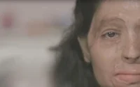 Maroc : la police dément des attaques à l'acide ciblant les femmes