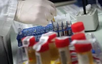 Coronavirus : le Maroc détecte de nouveaux cas suspects