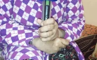 Marrakech : elle découvre, six ans plus tard, qu'on lui a volé un rein (vidéo)