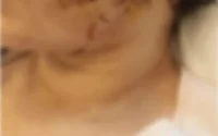 Molenbeek : une femme défigurée par son ex-mari