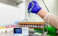 Covid-19 : le Kit de diagnostic 100% marocain disponible