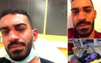 France : des Jordaniens tabassés car ils parlaient arabe