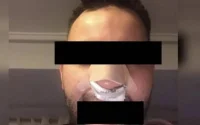Un Marocain victime d'une agression raciste en Espagne