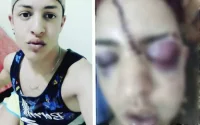 Un MRE d'Espagne victime d'une agression homophobe à Kénitra