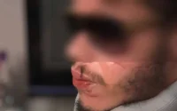 Dents cassées : un Marocain violemment agressé par un policier à Paris