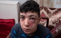 Violences policières sur Mounaim : la justice classe l'affaire