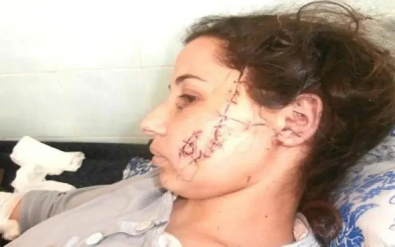Une Marocaine sauvagement agressée par un tueur à gages