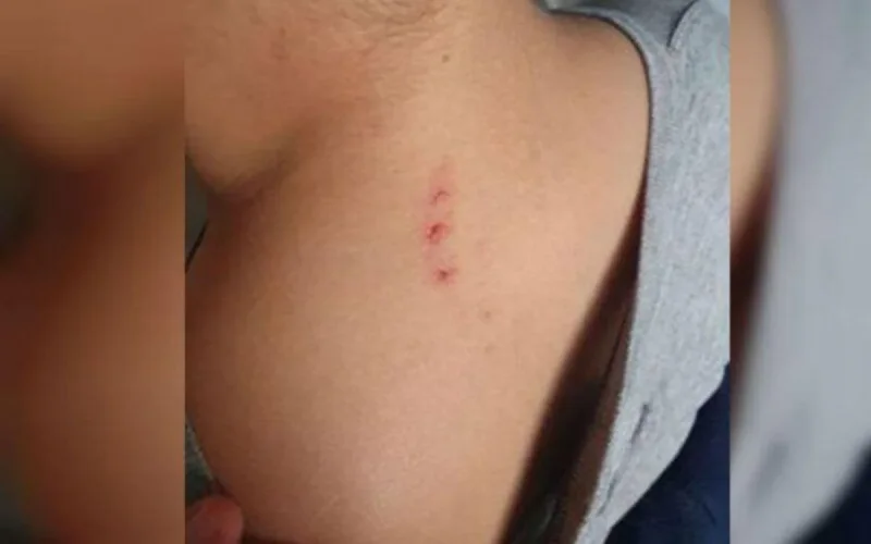 Seine-et-Marne : Bilal, 8 ans, tabassé par sa professeure