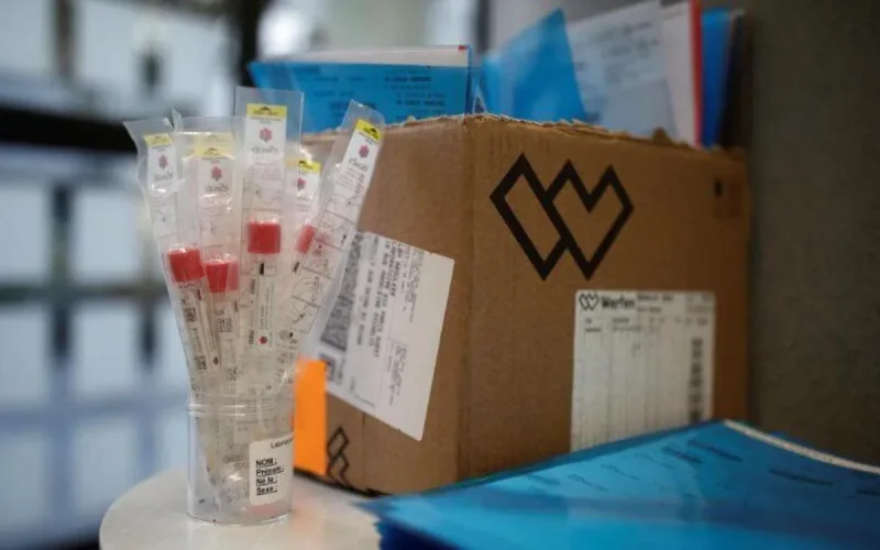 Le Maroc aurait commandé 700 000 kits de tests sud-coréens