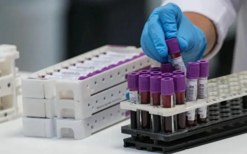 Enfin un traitement efficace contre le coronavirus ?